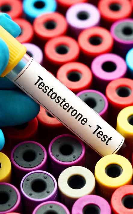 Testosterone test