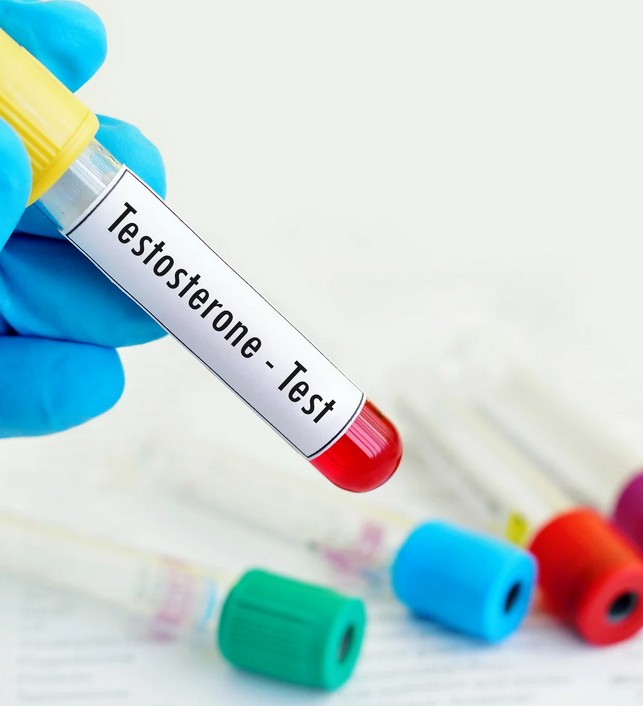 Testosterone test